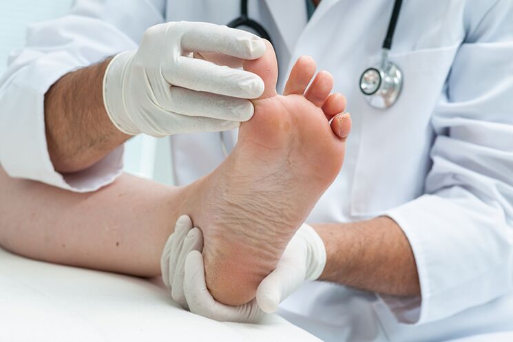 dermatolog zkoumá nohy pacienta