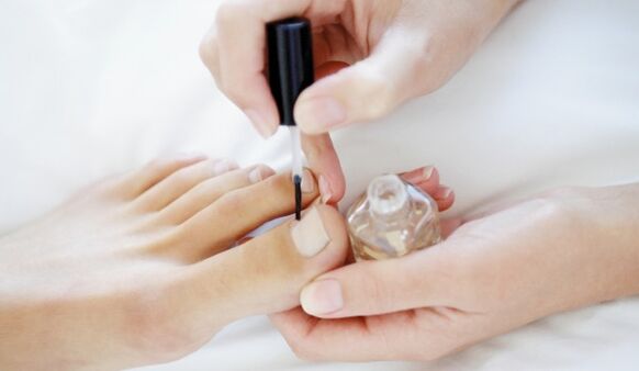 Aplikace léčivého laku na nehty je povinným denním postupem při ošetření plísní. 